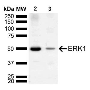 Western blot analysis of mouse, rat brain showing detection of ~43.1, 38.2, 40.1 kDa ERK1 protein using Anti-ERK1 Antibody (A305048) at 1:1,000 for 2 hours at room temperature