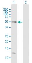 Anti-HAVCR1 Mouse Polyclonal Antibody