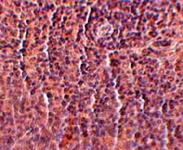 Anti-ORAI3 Mouse Monoclonal Antibody [clone: 2H2G9]