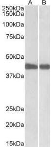 Anti-IDH1 Antibody (A84906) (0.1 µg/ml) staining of Mouse (A) and Rat (B) Liver lysates (35 µg protein in RIPA buffer). Primary incubation was 1 hour. Detected by chemiluminescence