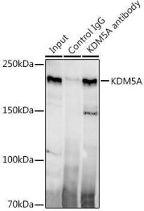 Immunoprecipitation analysis of 300 µg extracts of HeLa cells using 3 µg of Anti-KDM5A/Jarid1A/RBBP2 Antibody [ARC1120] (A306168) This Western blot was performed on the immunoprecipitate using Anti-KDM5A/Jarid1A/RBBP2 Antibody [ARC1120] (A306168) at a dilution of 1:500