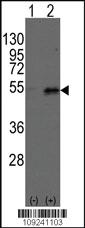 Anti-DTNBP1 Rabbit Polyclonal Antibody