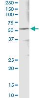 Anti-ALDH3A1 Antibody Pair