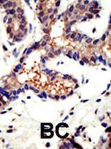 Anti-UBQLN3 Rabbit Polyclonal Antibody (AP (Alkaline Phosphatase))