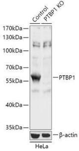 Anti-PTBP1 antibody