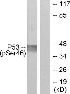 Western blot analysis of lysates from 293 cells treated with UV using Anti-p53 (phospho Ser46) Antibody. The right hand lane represents a negative control, where the antibody is blocked by the immunising peptide