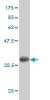 Anti-TEK Mouse Monoclonal Antibody [clone: 5G6]