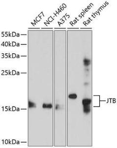 Western blot analysis of extracts of various cell lines, using Anti-JTB Antibody (A8615) at 1:1,000 dilution