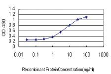 Anti-C4B Mouse Monoclonal Antibody [clone: 2E3]