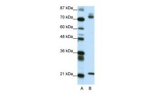 Anti-SATB1 Rabbit Polyclonal Antibody