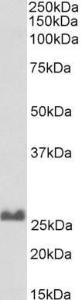 Anti-SNAP25 Antibody (A83292/Biotin) (0.1 µg/ml) staining of Rat Brain lysate (35 µg protein in RIPA buffer), exactly mirroring its parental non-biotinylated product. Primary incubation was 1 hour