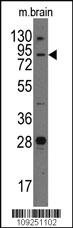 Anti-JPH3 Rabbit Polyclonal Antibody