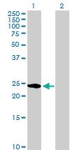 Anti-HSPB1 Rabbit Polyclonal Antibody