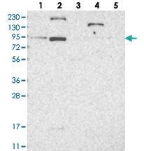 Anti-LCA5 Rabbit Polyclonal Antibody