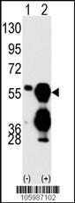 Anti-PPM1F Rabbit Polyclonal Antibody