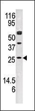 Anti-AK3 Rabbit Polyclonal Antibody (APC (Allophycocyanin))