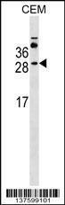 Anti-MS4A3 Rabbit Polyclonal Antibody (HRP (Horseradish Peroxidase))