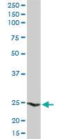 Anti-HSPB1 Rabbit Polyclonal Antibody