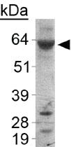 Anti-PLIN1 Rabbit Polyclonal Antibody