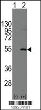 Anti-ERVW-1 Rabbit Polyclonal Antibody