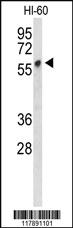 Anti-PLVAP Rabbit Polyclonal Antibody