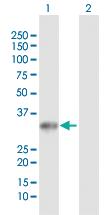 Anti-UCK2 Rabbit Polyclonal Antibody