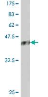 Anti-DOT1L Mouse Polyclonal Antibody