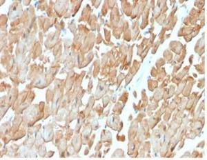 Immunohistochemical analysis of formalin-fixed, paraffin-embedded human heart muscle tissue using Anti-Dystrophin Antibody [DMD/3676]