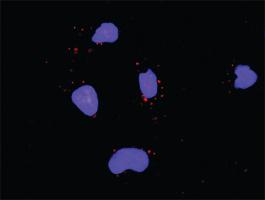 Anti-APC + CSNK2A1 Antibody Pair