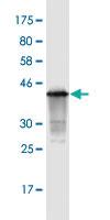 Anti-CDKN2B Mouse Monoclonal Antibody [clone: 8C4]