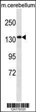 Anti-CAMSAP3 Rabbit Polyclonal Antibody (APC (Allophycocyanin))