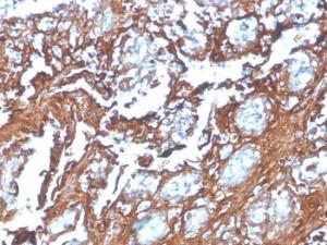 Anti-Annexin A1 Mouse Recombinant Antibody [clone: rANXA1/4310]