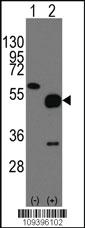 Anti-NPTX2 Rabbit Polyclonal Antibody