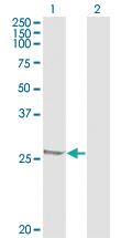 Anti-HSPB1 Mouse Monoclonal Antibody [clone: 3G3]