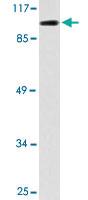 Anti-DGKQ Rabbit Polyclonal Antibody