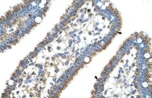 Anti-CPS1 Rabbit Polyclonal Antibody