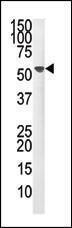 Anti-PPM1F Rabbit Polyclonal Antibody (FITC (Fluorescein))