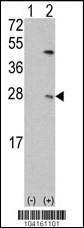 Anti-UBE2C Rabbit Polyclonal Antibody (AP (Alkaline Phosphatase))