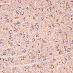 Immunohistochemistry analysis of paraffin-embedded mouse brain using Anti-14-3-3 gamma/YWHAG Antibody [ARC1457] (A309079) at a dilution of 1:100 (40X lens). Perform microwave antigen retrieval with 10 mM Tris/EDTA buffer pH 9.0 before commencing with IHC staining protocol