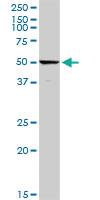 Anti-C4BPA Rabbit Polyclonal Antibody