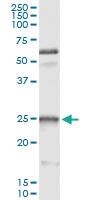 Anti-HSPB1 Mouse Monoclonal Antibody [clone: 3G3]