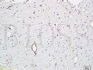 Anti-VWF Rabbit Polyclonal Antibody