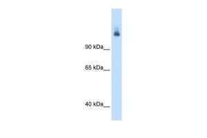 Anti-CPS1 Rabbit Polyclonal Antibody