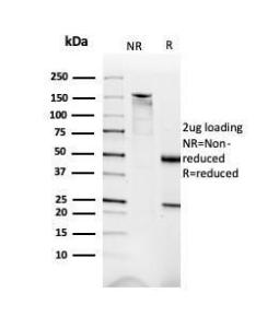 SDS-PAGE analysis of Anti-Dystrophin Antibody [DMD/3676] under non-reduced and reduced conditions; showing intact IgG and intact heavy and light chains, respectively. SDS-PAGE analysis confirms the integrity and purity of the Antibody