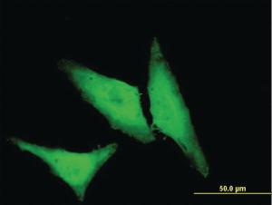 Anti-HSPB1 Mouse Monoclonal Antibody [clone: 3G3]