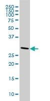 Anti-CNOT7 Mouse Monoclonal Antibody [clone: 2F6]