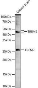 Western blot analysis of extracts of Mouse brain, using Anti-TREM2 Antibody (A8628) at 1:1000 dilution