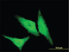 Anti-HSPB1 Mouse Monoclonal Antibody [clone: 3G3]