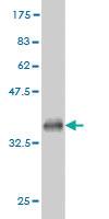 Anti-TEK Mouse Monoclonal Antibody [clone: 2G2]