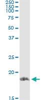 Anti-STMN1 Antibody Pair